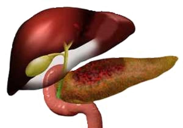 Острый панкреатит