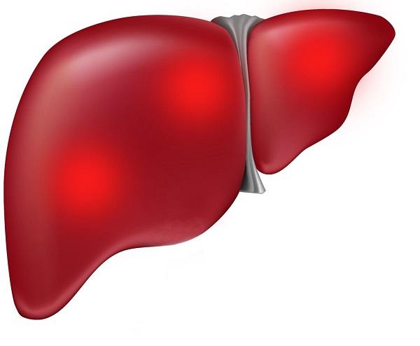 Печеночная недостаточность