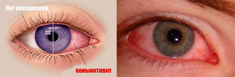 норма патология