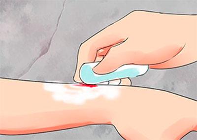 Удаление яда с кожи