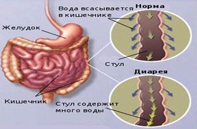 Следствие диареи