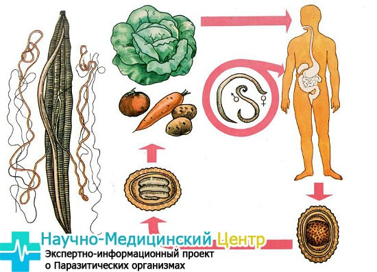 pyti_zarazheniya_askaridami_gemoparazit_w212-min.jpg
