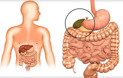 Застой желчи