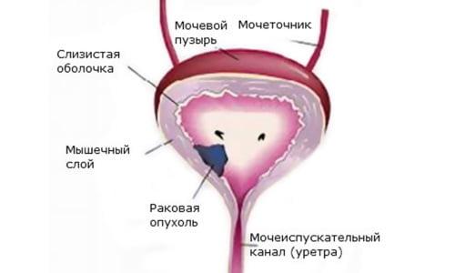 Новообразование