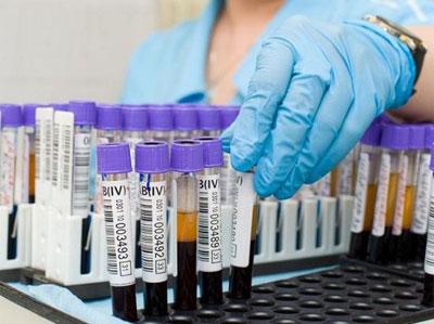 Анализ крови