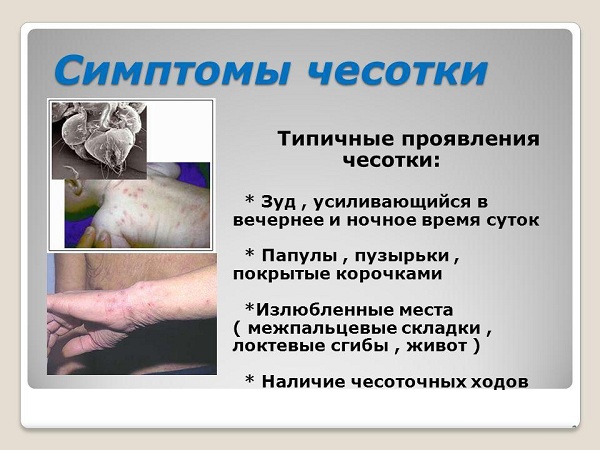 симптомы-чесотки.jpg