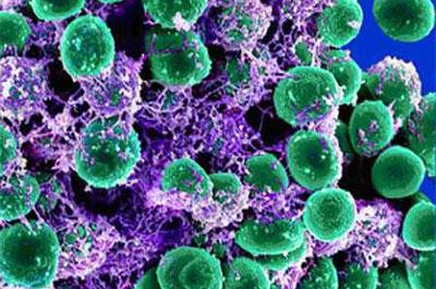 Стафилококковая инфекция