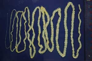 taenia_saginatus.jpg