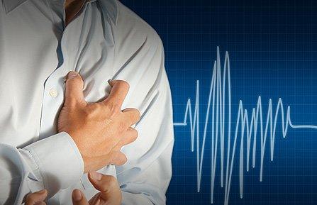 Тахикардия