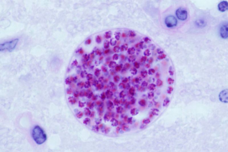 toxoplasma-gondii.jpg