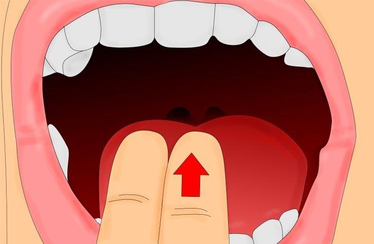 Вызов рвоты с помощью двух пальцев