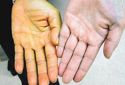 Желтая кожа